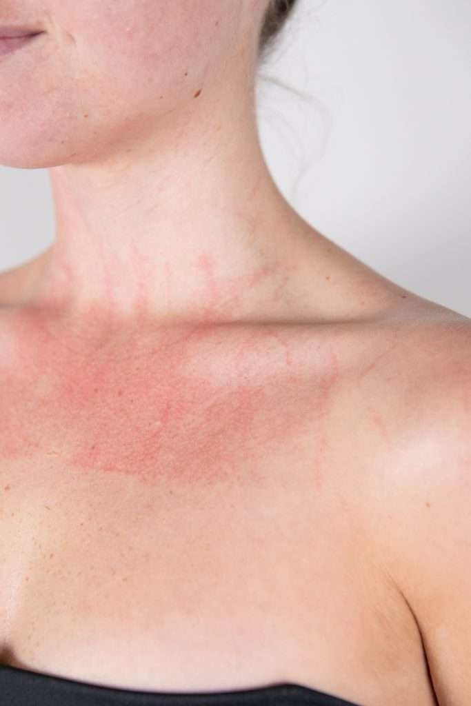 Plasma response post PRIN Lymphatic Therapy in Perth